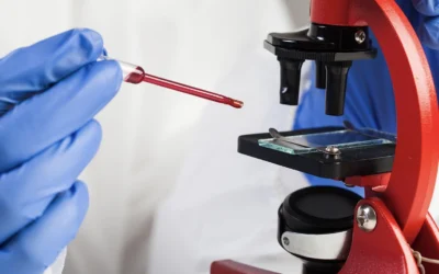 EMB-test: wat is het en wat kan het betekenen bij overgangsklachten?